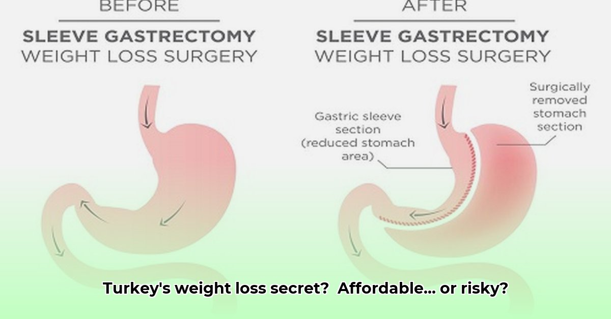 turkey-weight-loss-surgery